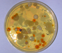 microbes in a substance in a petri dish